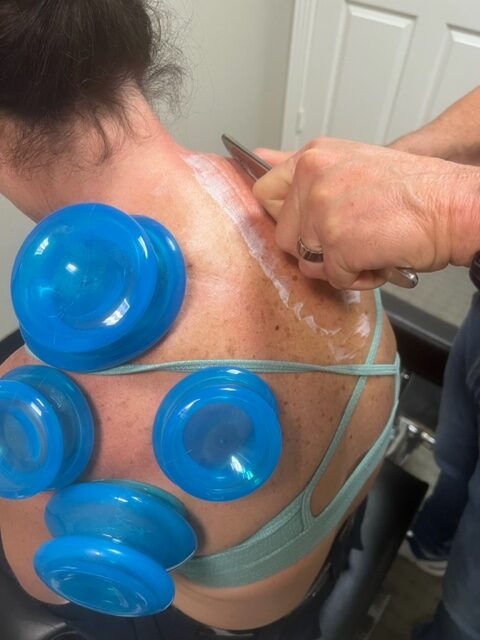 Cupping Physical Therapy